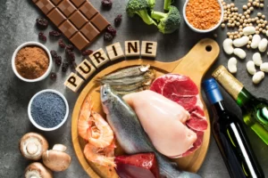 Sakit Asam Urat Tidak Boleh Makan Apa Saja? Simak Ini!