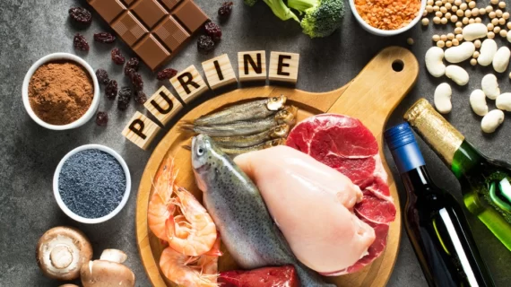 Sakit Asam Urat Tidak Boleh Makan Apa Saja? Simak Ini!