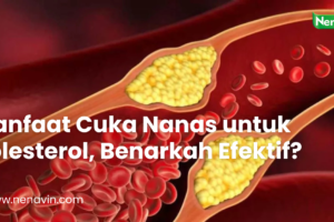 Manfaat Cuka Nanas untuk Kolesterol, Benarkah Efektif?